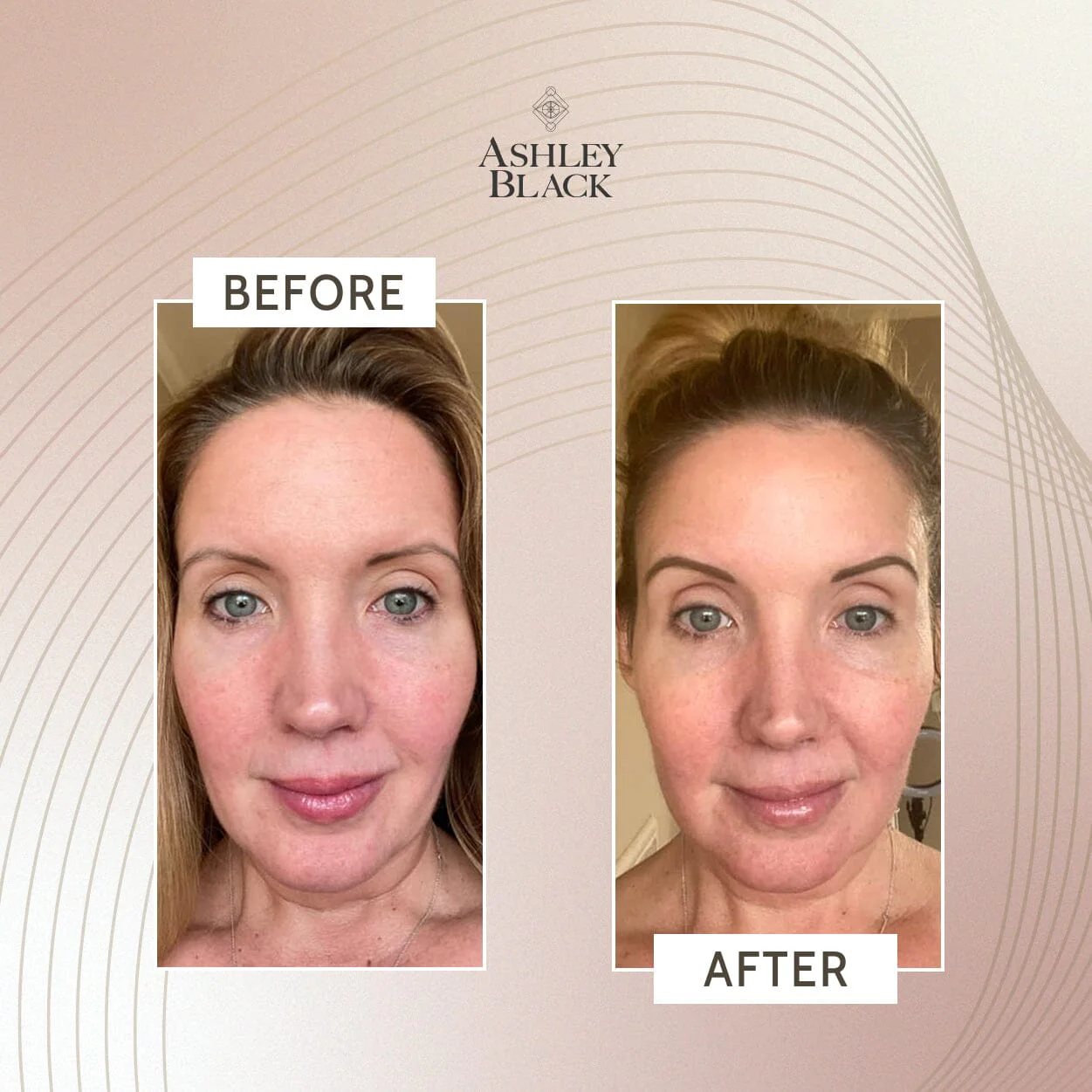 Ashley Black's Kryopack™ Face Wrap - Image 5